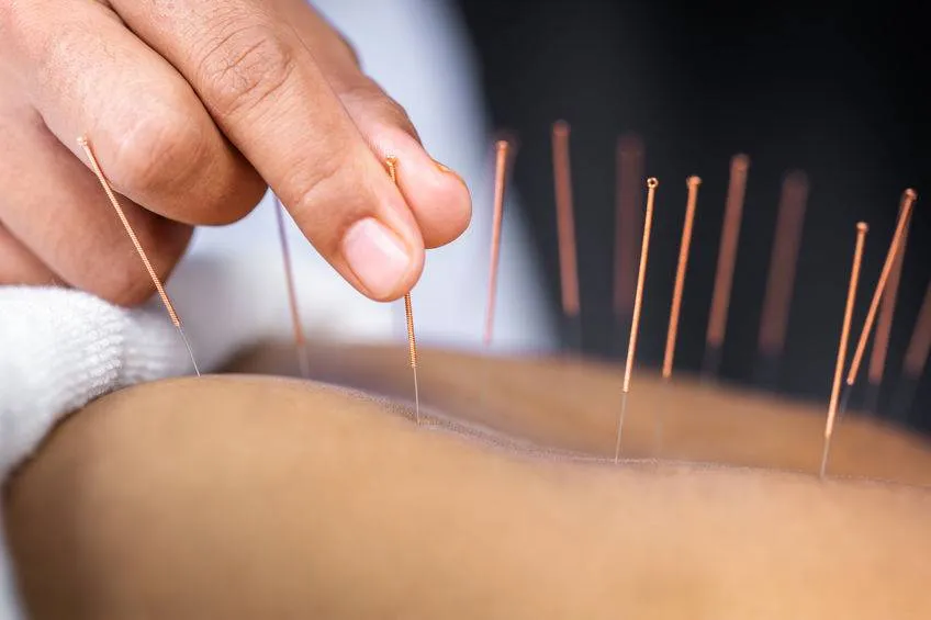 acupuncture in denver