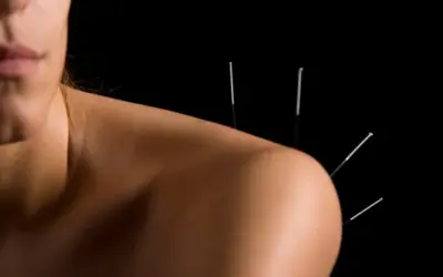 Can Dry Needling Cause Diarrhea?