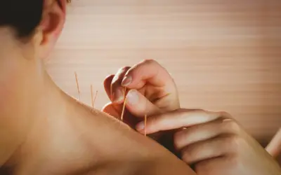 Can Dry Needling Make Pain Worse? What You Need to Know