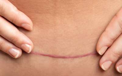 Exercise After C Section: A Week by Week Guide to Rebuilding Strength